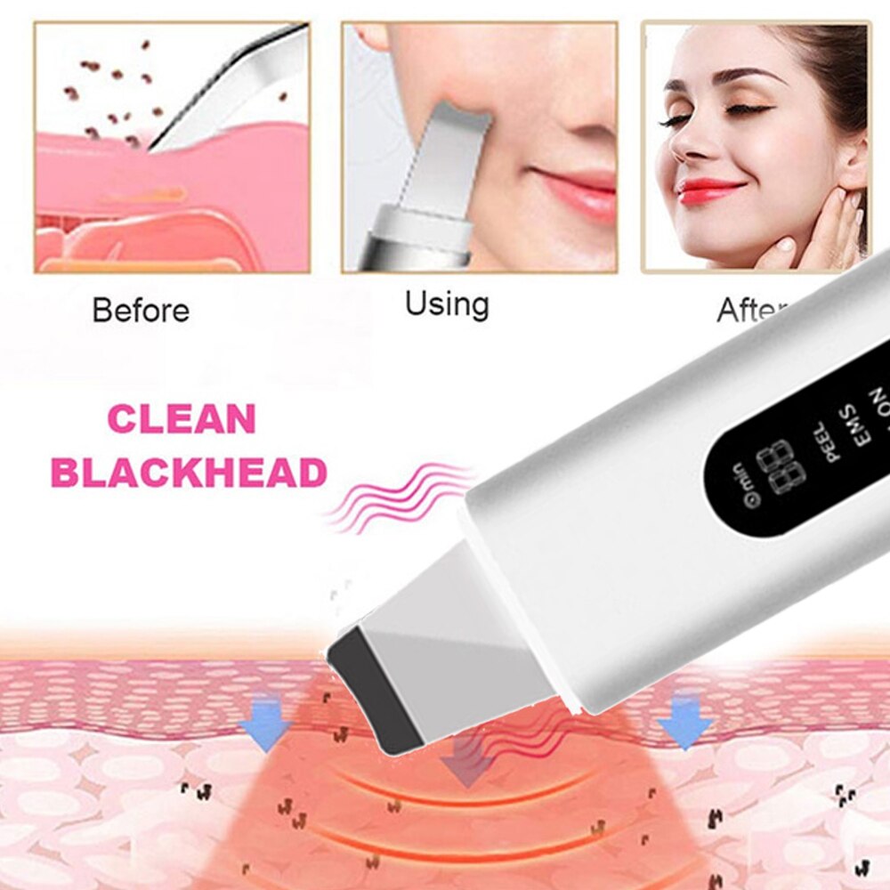 GlowEase™ Skin Scrubber - Your Path to Flawless Skin!